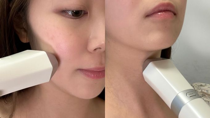 美容儀推薦｜編輯實測日本人氣Notime美容儀！RF逆齡儀好用嗎？
