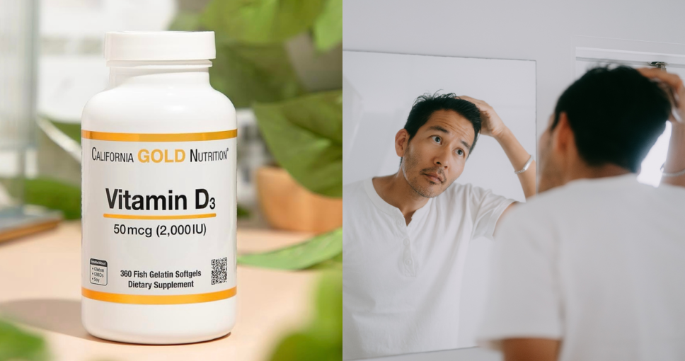 鬼剃頭成因｜鬼剃頭維他命/洗頭水/藥膏全攻略！附鬼剃頭食療清單